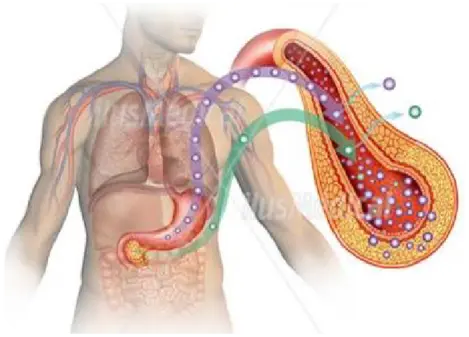 Muestra gráfica de diabetes millitus