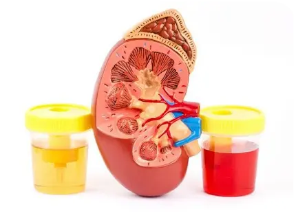 Mitos sangre en la orina