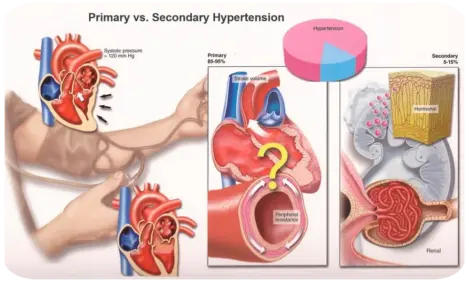 Muestra gráfica de la presión arterial