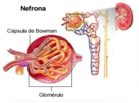 Gráfica del síndrome nefrítico